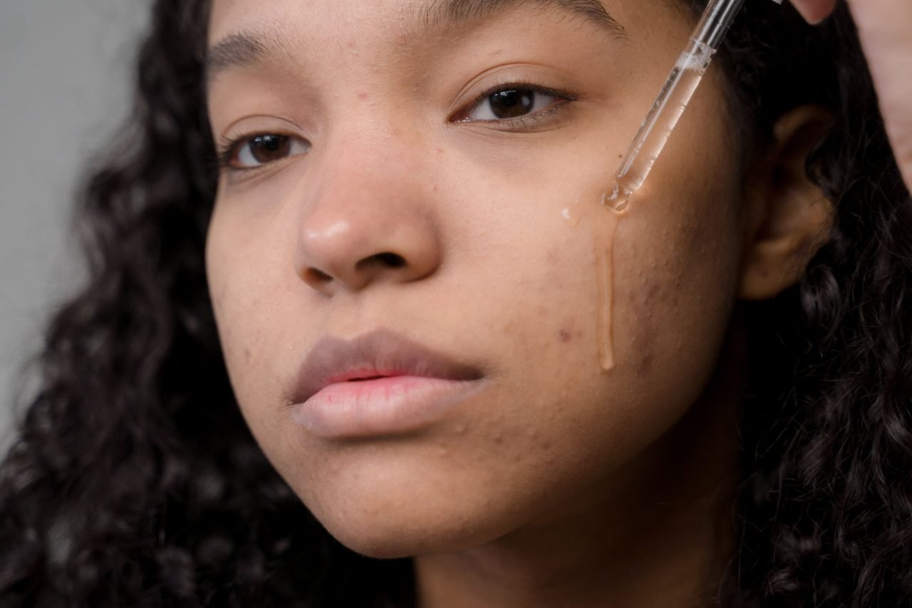 applying snail mucin essence to skin
