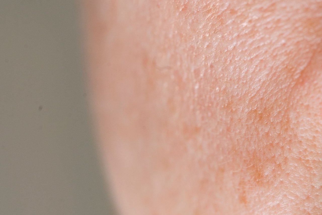 microscopic skin texture close-up