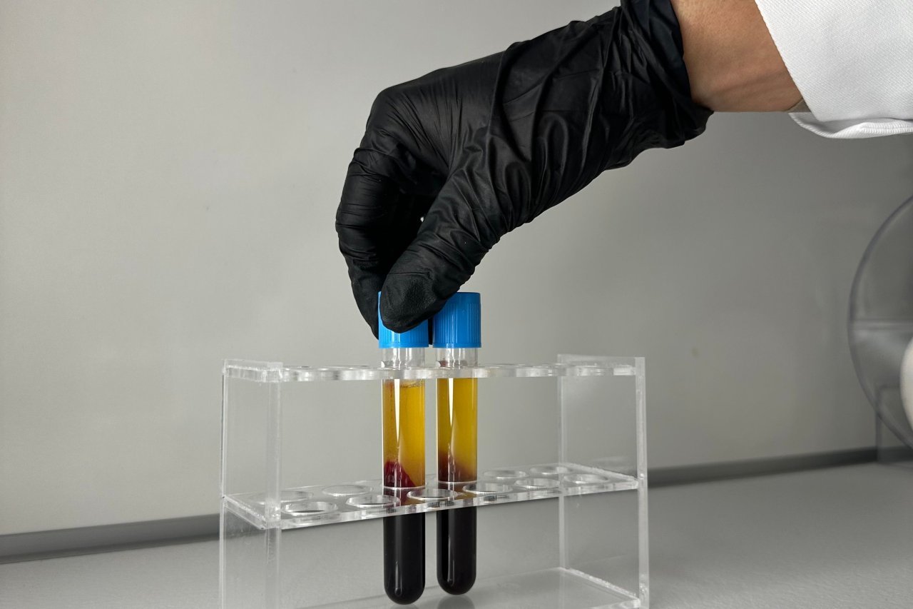 blood sample testing in a lab